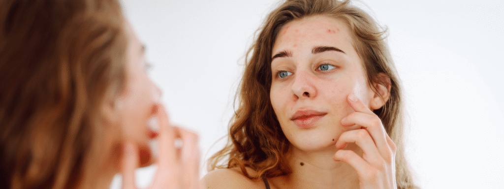 Red Light Therapy Device Recommendations